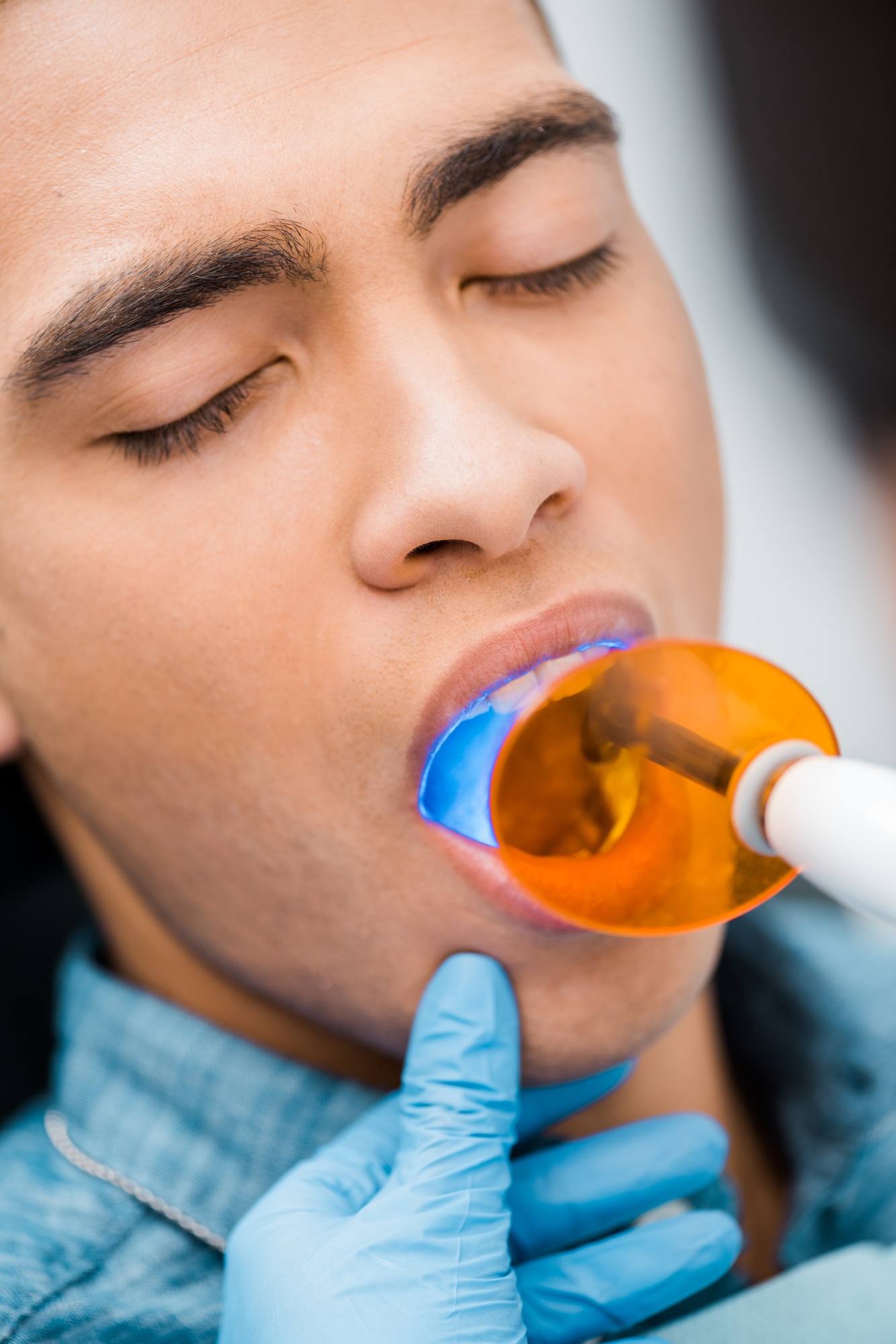 close up of handsome african american man during whitening procedure