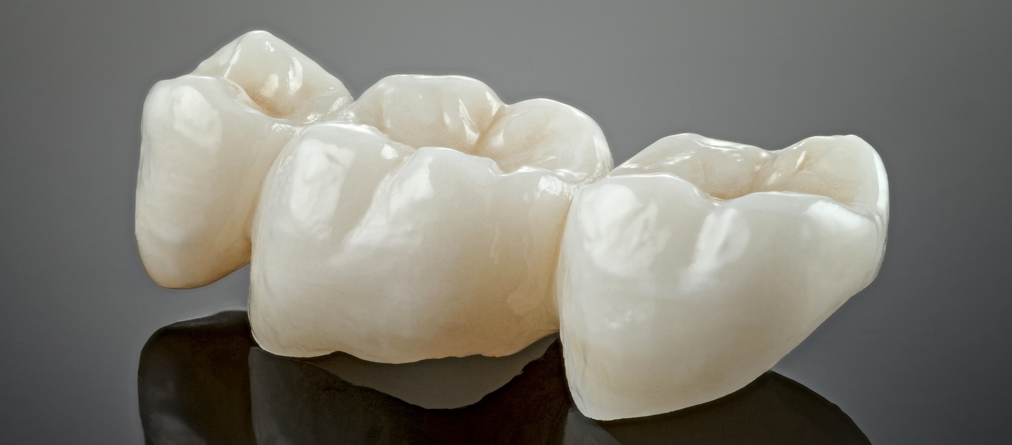 Metal free ceramic dental crowns