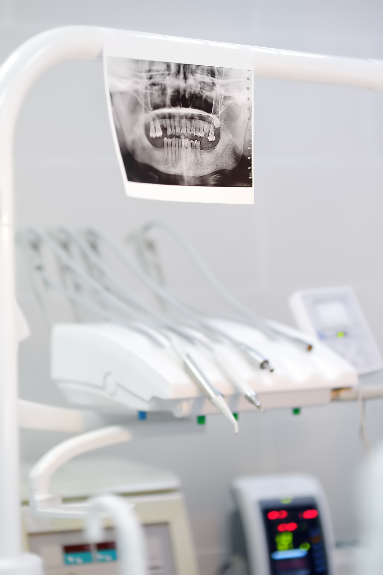 X-ray on the background of professional dentistry equipment during a dental operation in hospital